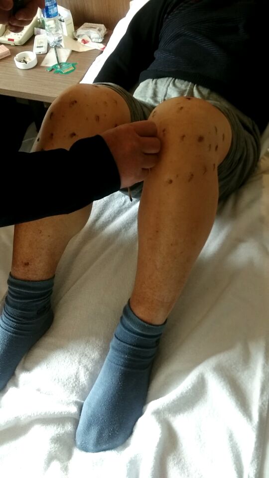 老蕭頭問醫記（jì）